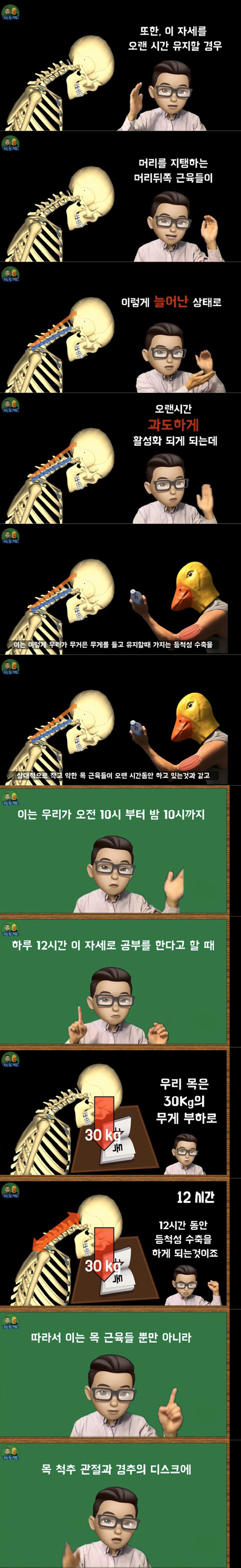 공부할때 고개를 숙이고 하면 안되는 이유. 통증 유발 이유 | 인스티즈