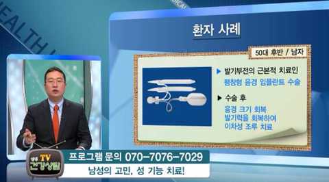 꼬추 이미지