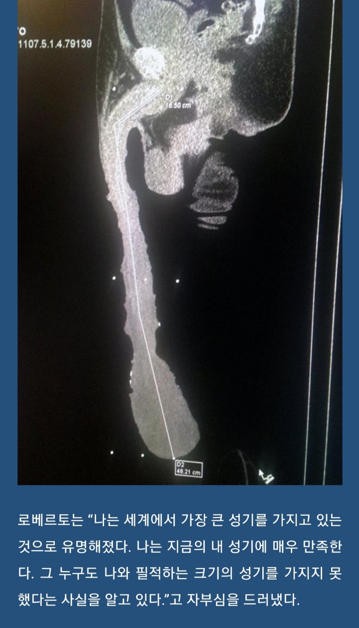 세계에서 가장 긴 페니스를 가진 남자 | 인스티즈