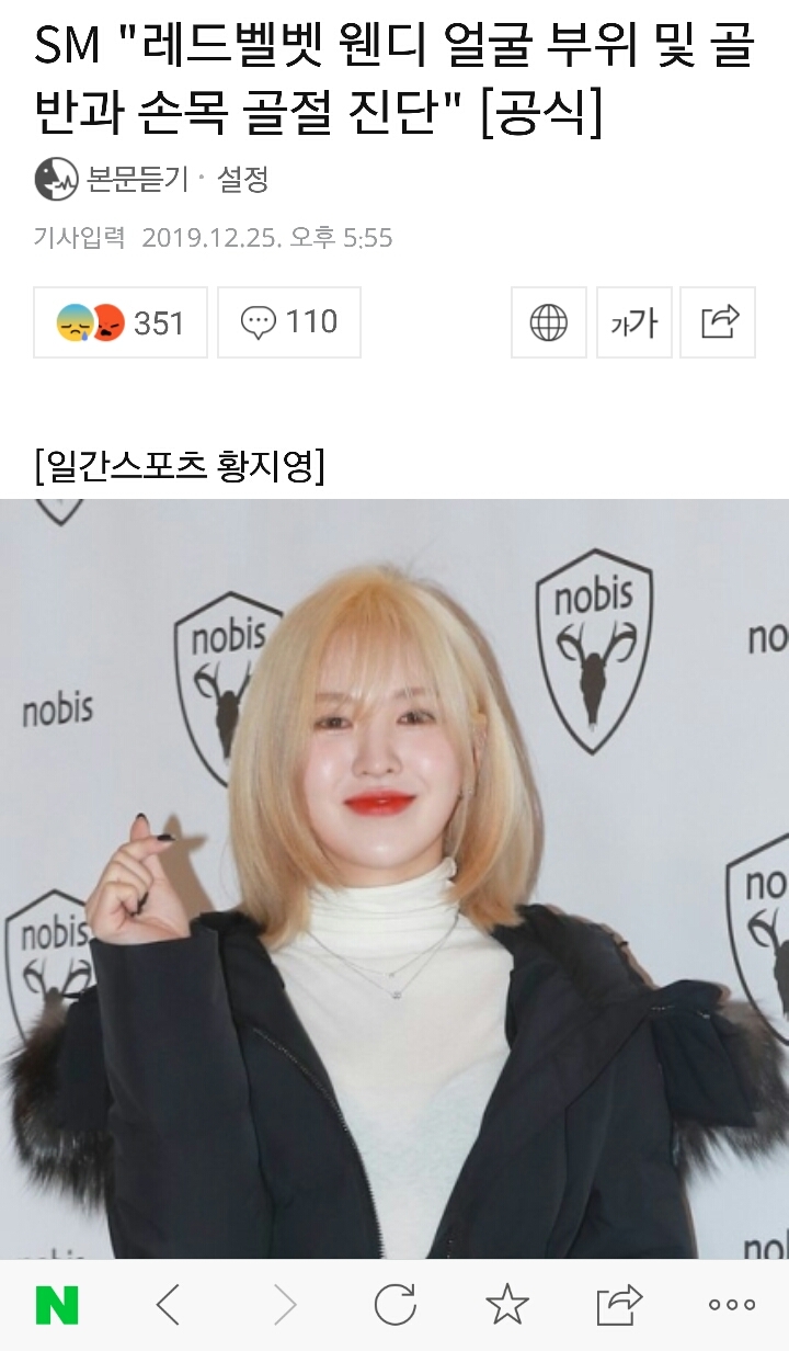 레드벨벳 웬디가 생각보다 크게 다치자 부랴부랴 사과문 올린 SBS | 인스티즈