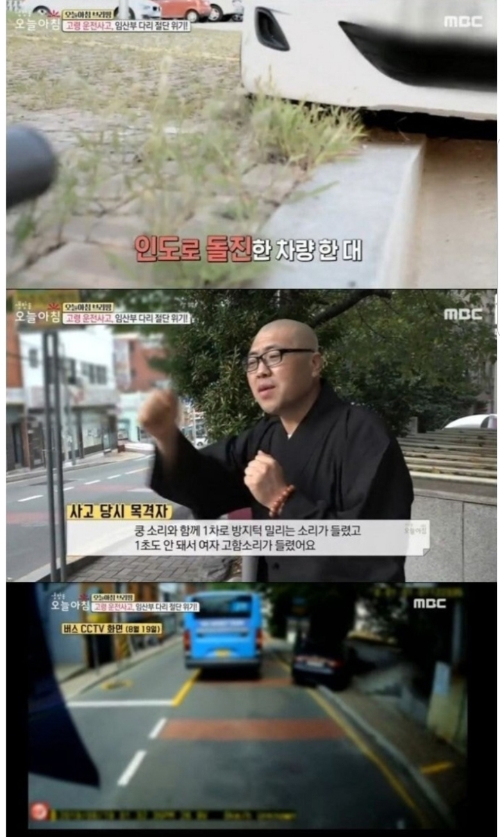 아기를 위해 마취 없이 8시간 수술을 받은 임산부.jpg | 인스티즈