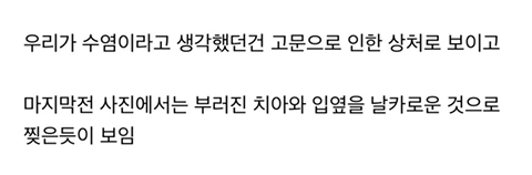 도마 안중근 의사 사진 복원 | 인스티즈