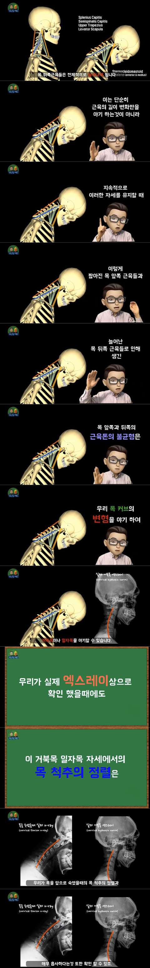 공부할때 고개를 숙이고 하면 안되는 이유. 통증 유발 이유 | 인스티즈