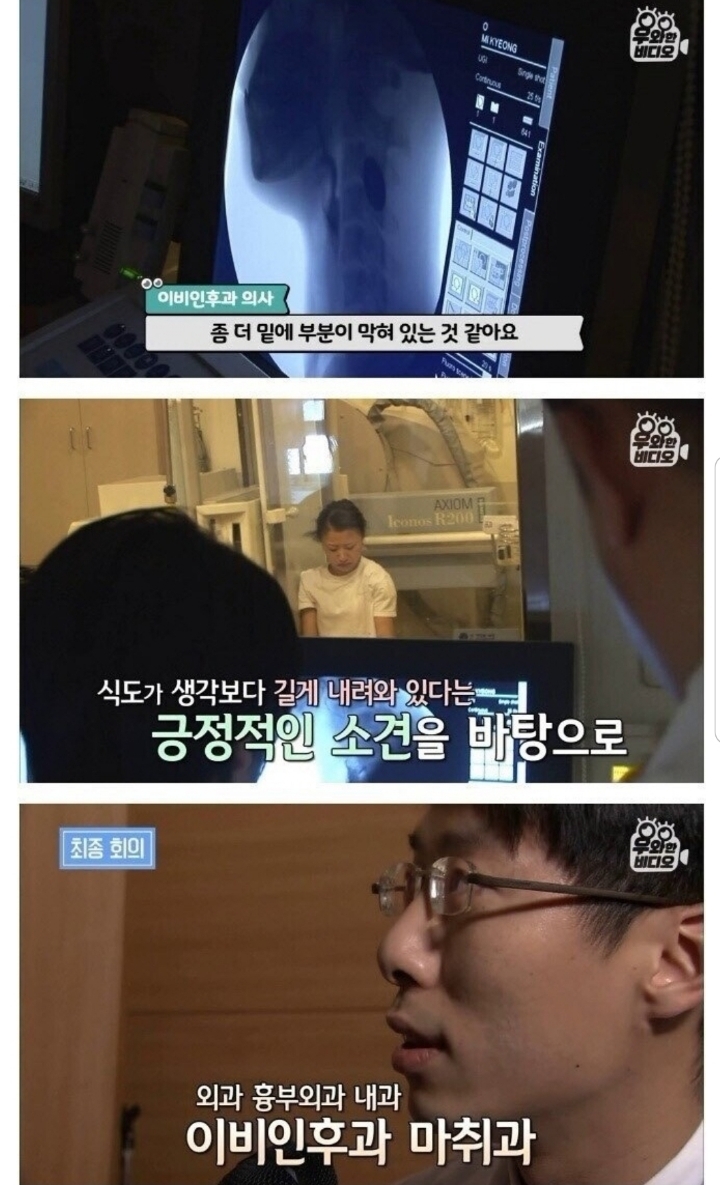 스압) 식도가 없이 태어난 아이.jpg | 인스티즈