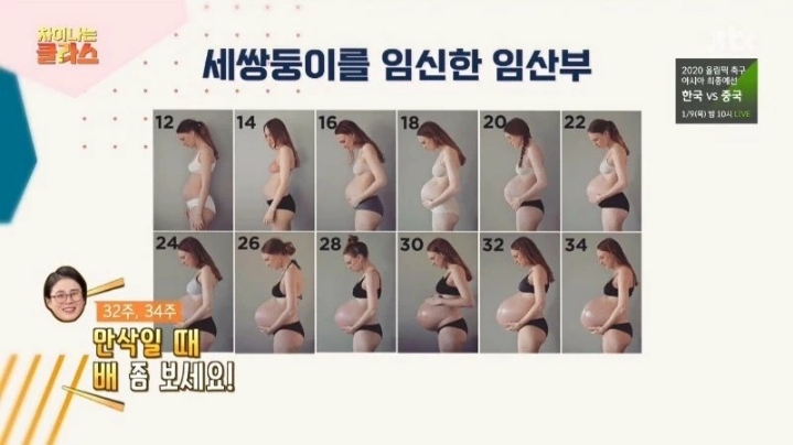 세쌍둥이를 임신한 임산부 | 인스티즈