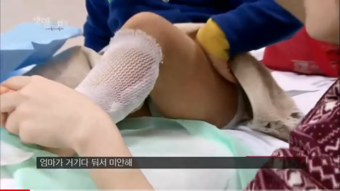 엄마한테 미안하다고하는 화상입고온 4살 지환이.jpg | 인스티즈