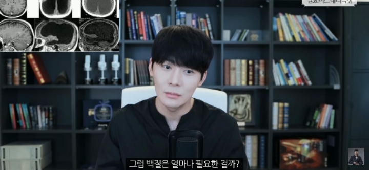 [풀수없는미스테리] 뇌가 없어도 멀쩡한 사람들, 뇌는 필요한 게 맞을까? | 인스티즈