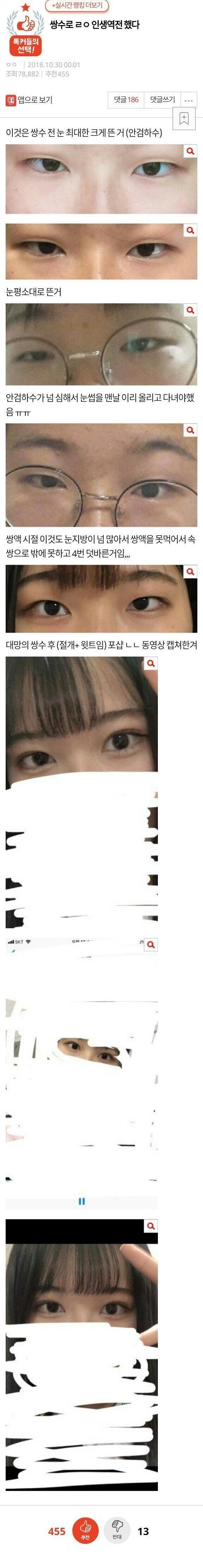 쌍수로 인생역전 했다 | 인스티즈