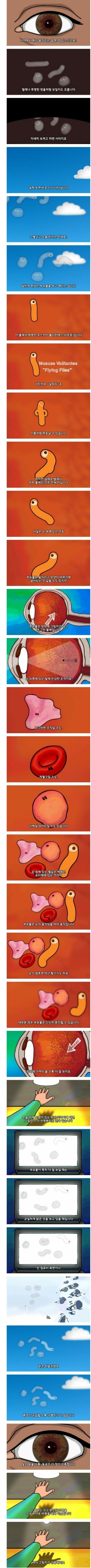 가끔 눈에 뭐 떠다니는거 같으면 들어오세요 | 인스티즈