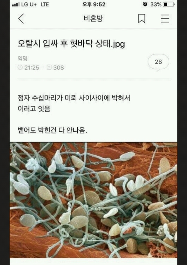 여자친구, 와이프에게 구강사정을 하면 안되는 이유 [ | 인스티즈