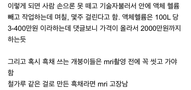 공포의 MRI 사고 사례.jpg | 인스티즈