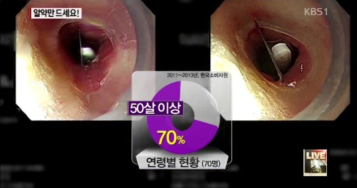 알약 이렇게 먹으면 안돼요! | 인스티즈