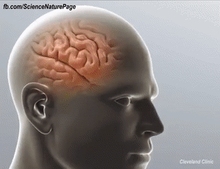 뇌종양 수술과정 | 인스티즈
