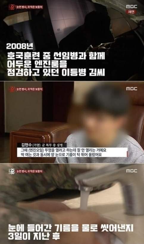 군대가서 다치면 나만 손해인 이유 | 인스티즈