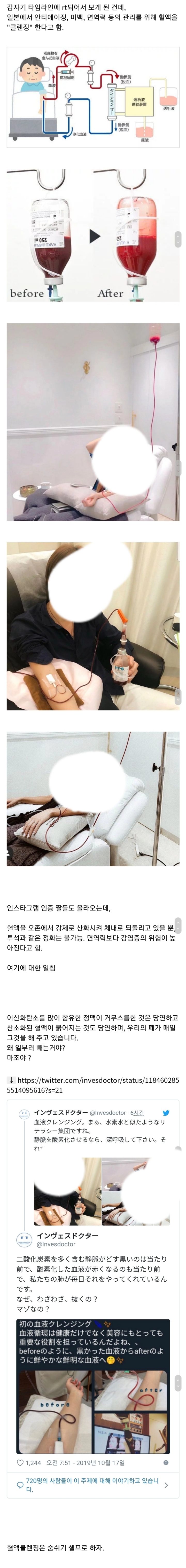 일본에서 볼수있다는 혈액클렌징 | 인스티즈