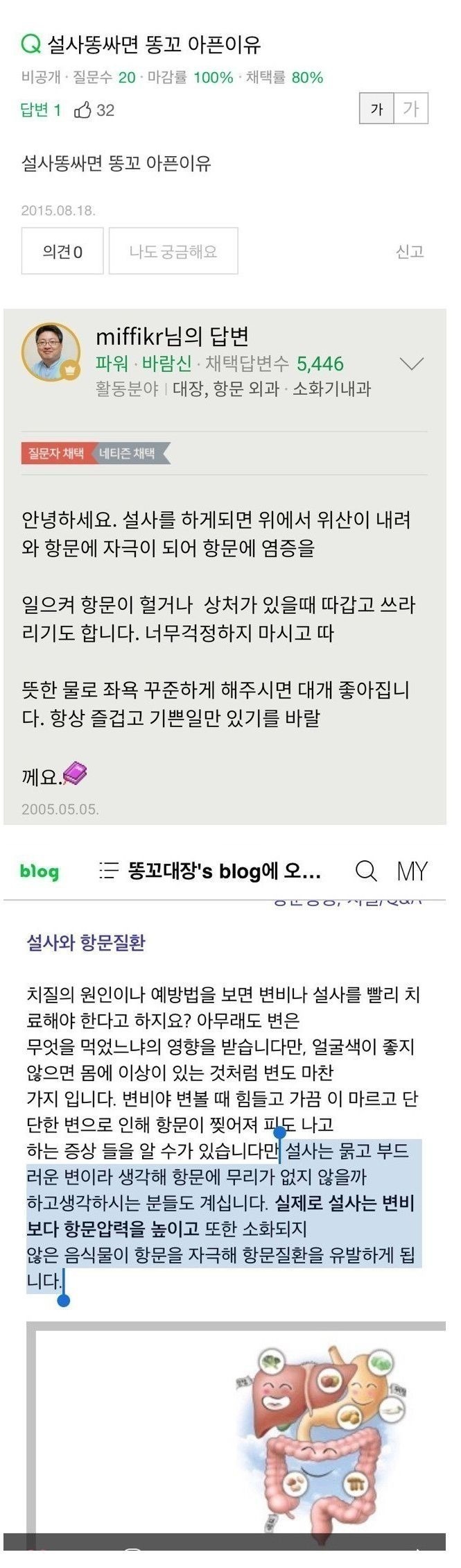 설사하면 항문아픈이유 | 인스티즈