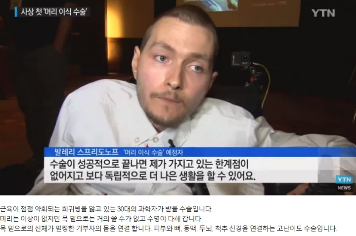 머리 이식 수술...jpg | 인스티즈