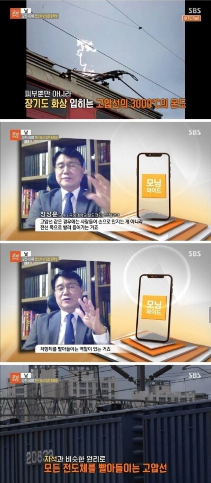 감전 사고로 전신 화상 입은 중학생.jpg | 인스티즈