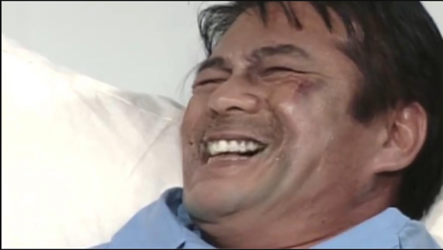 성기 이식수술이 성공한 사람.jpg | 인스티즈