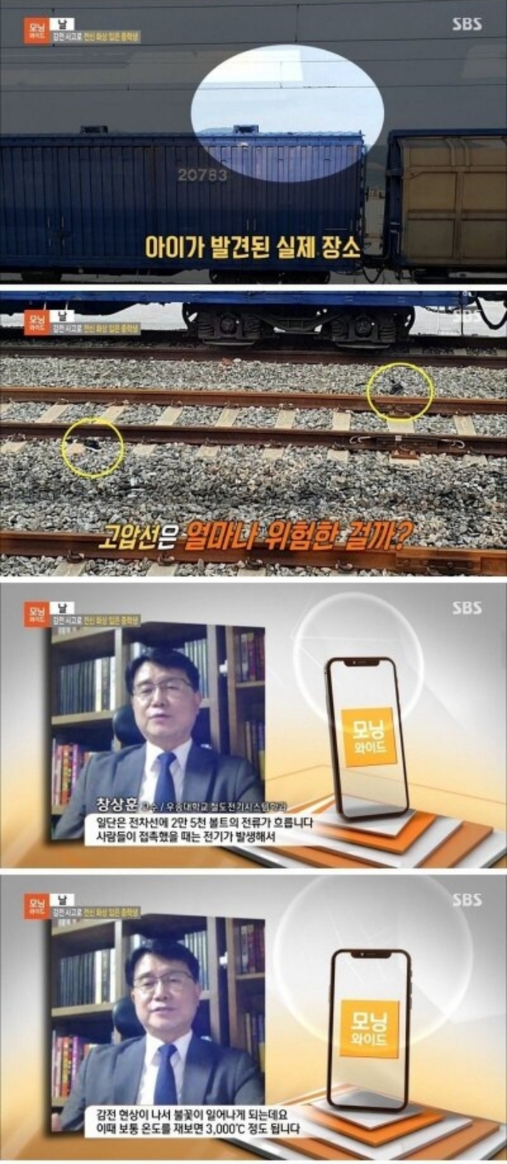 감전 사고로 전신 화상 입은 중학생.jpg | 인스티즈