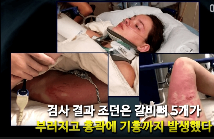 18m 높이의 다리 위에서 친구를 밀어버린 싸이코패스 | 인스티즈