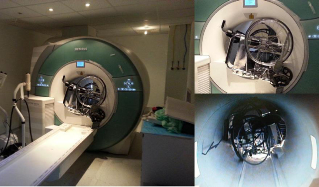 공포의 MRI 사고 사례.jpg | 인스티즈