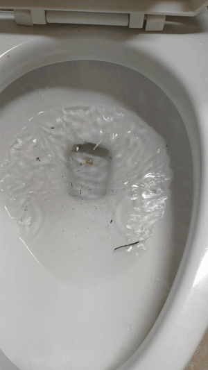 모기 새끼 다양하게 고문하는 모기 갤러리.jpgif | 인스티즈