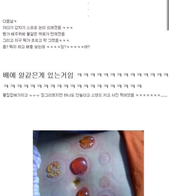 다이어트하다 배에 물집남 | 인스티즈