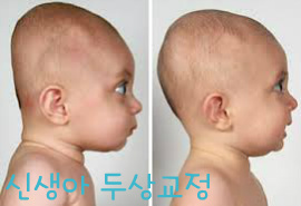 두상 이미지