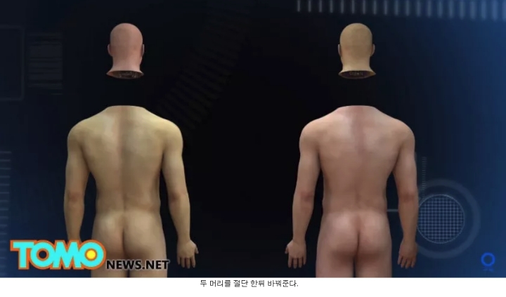 머리 이식 수술...jpg | 인스티즈