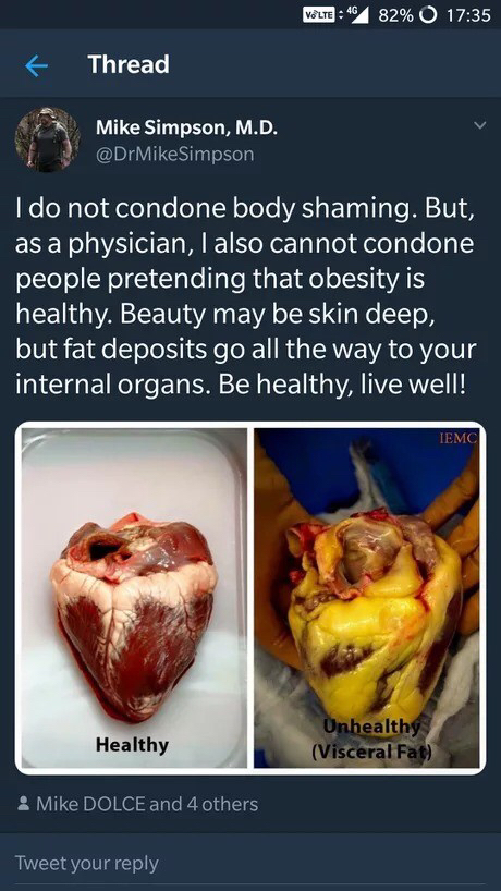 비만인의 심장.jpg (혐오주의) | 인스티즈