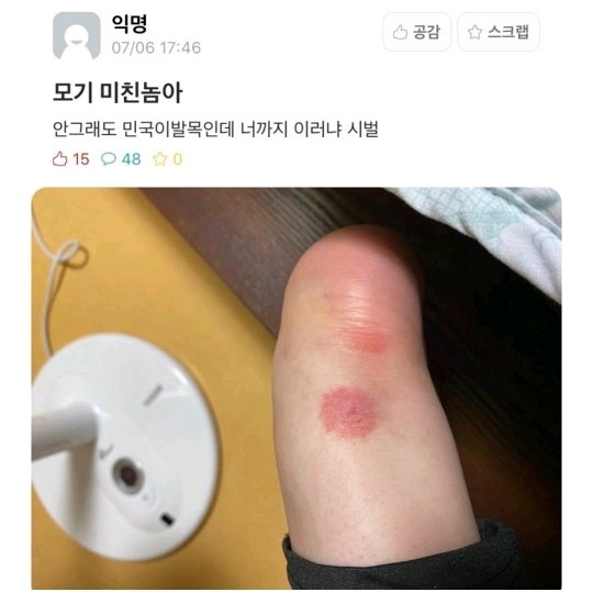 모기물린 곳 논란.jpg | 인스티즈