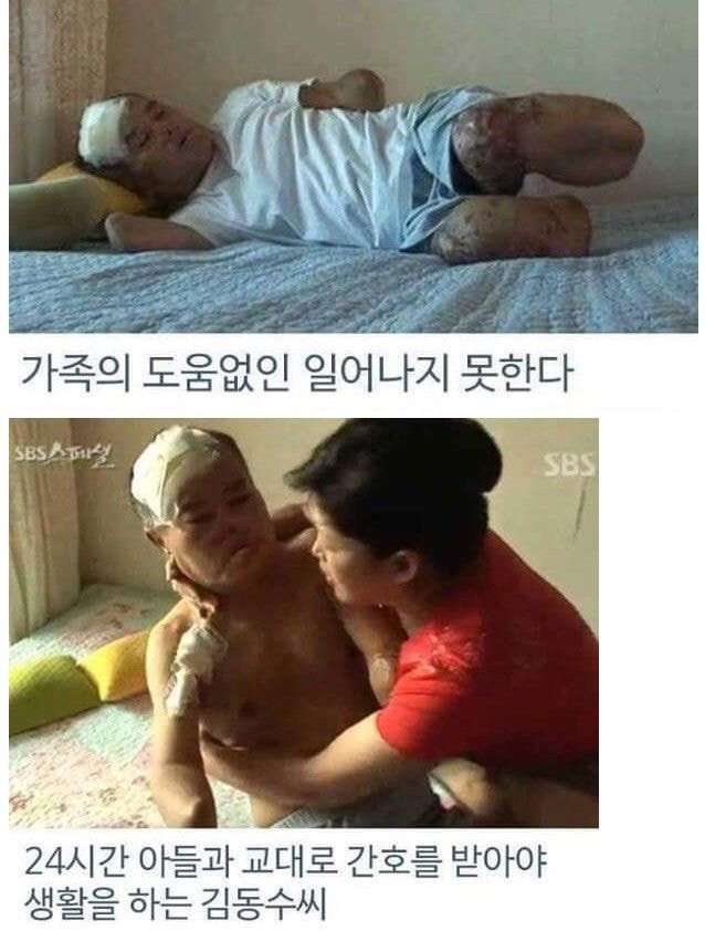 병원 실수로 하루아침에 사지 절단 | 인스티즈