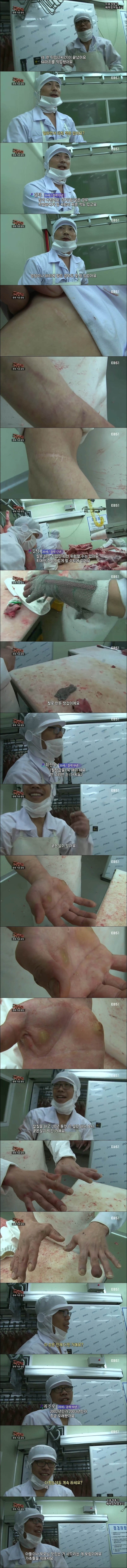 돼지발골 19년차의 손.jpg | 인스티즈