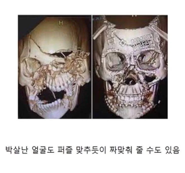 현대의학으로 가능한 것과 불가능한 것 | 인스티즈