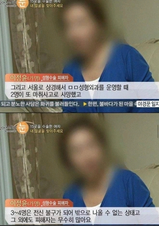 일부러 수술을 망치는 사이코패스 의사 | 인스티즈