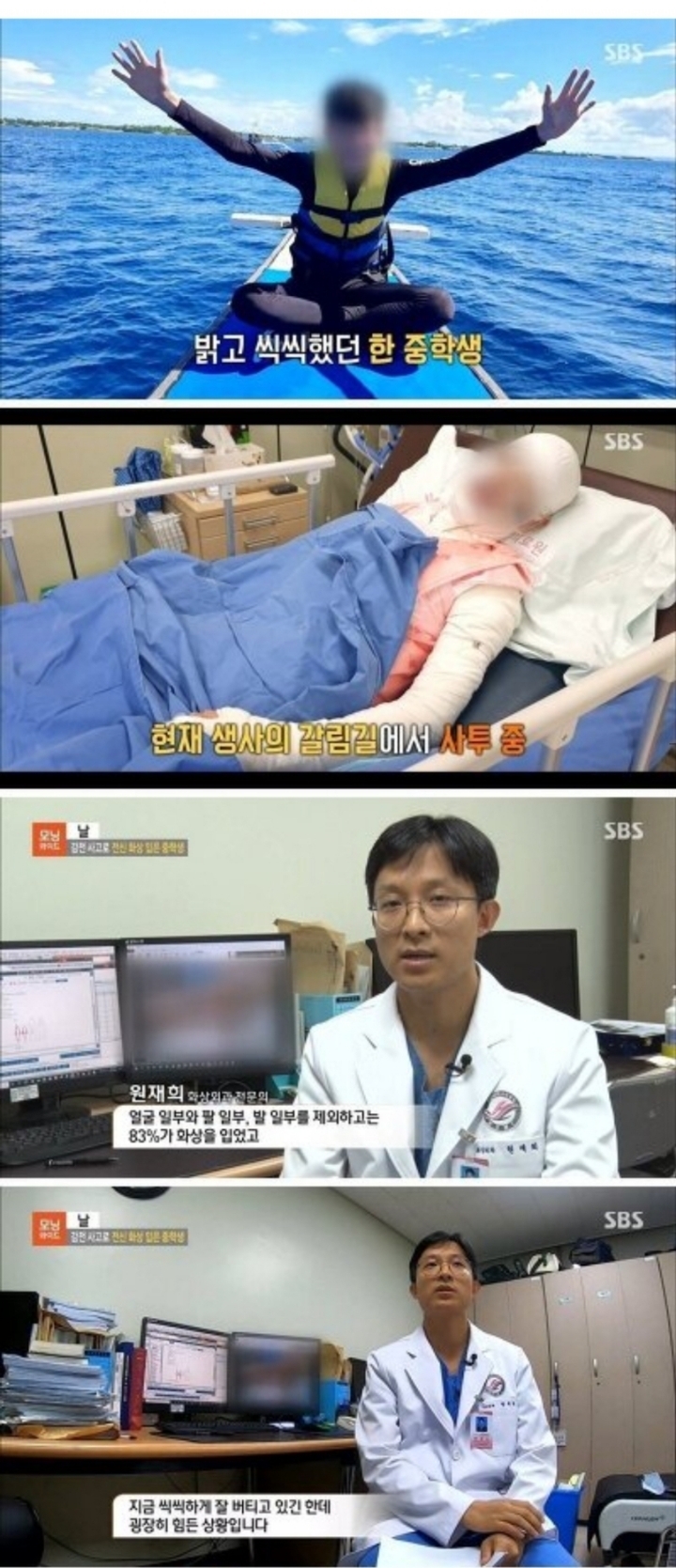 감전 사고로 전신 화상 입은 중학생.jpg | 인스티즈