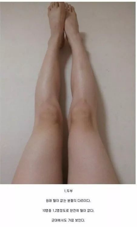 남자 다리털 유형 4가지 (혐오주의) | 인스티즈