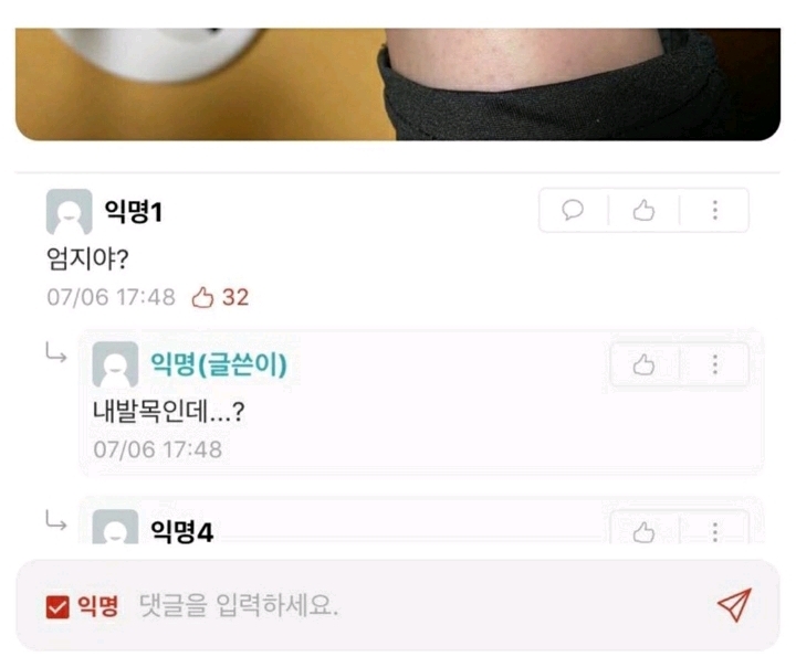 모기물린 곳 논란.jpg | 인스티즈