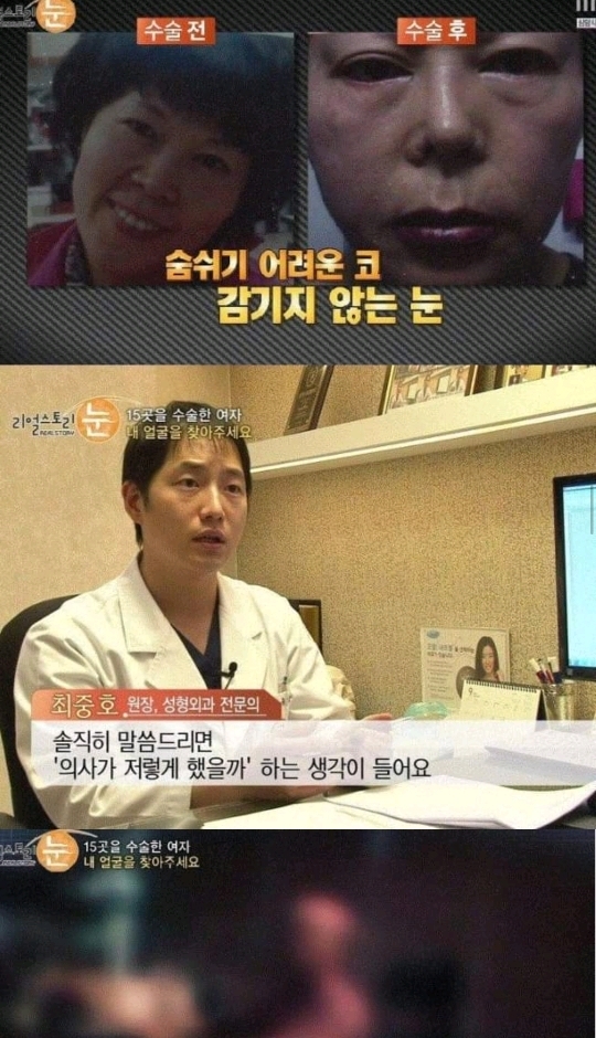 일부러 수술을 망치는 사이코패스 의사 | 인스티즈