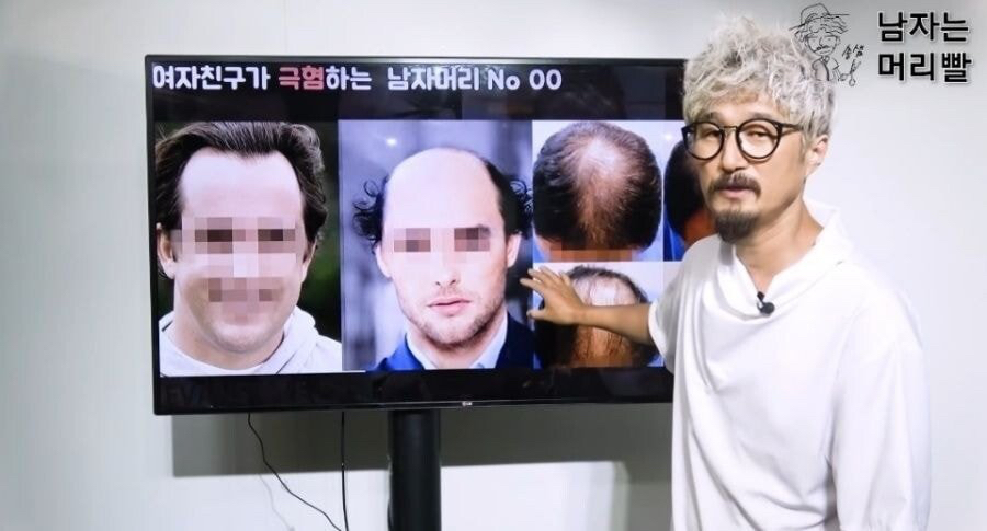 여자들이 싫어하는 남자 헤어스타일 top 5...jpg | 인스티즈