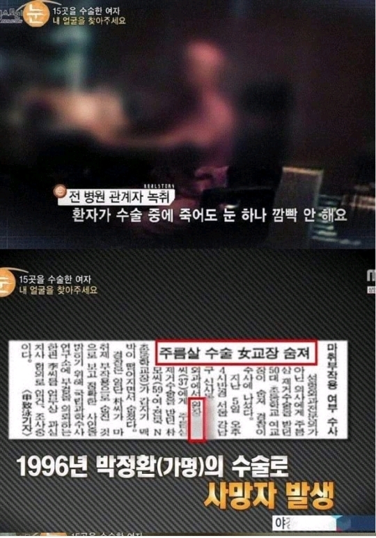 일부러 수술을 망치는 사이코패스 의사 | 인스티즈