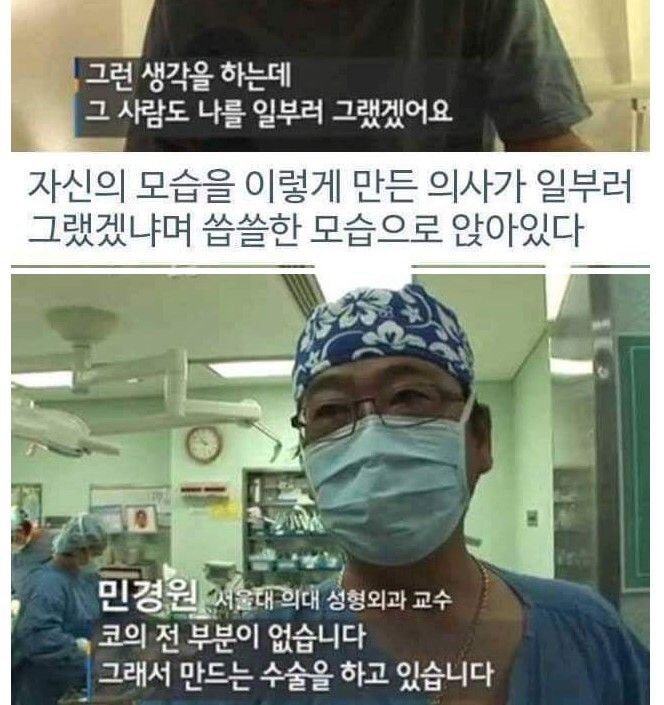 병원 실수로 하루아침에 사지 절단 | 인스티즈