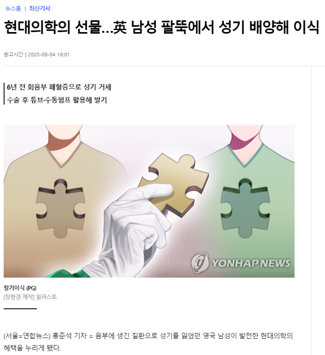 성기 이식수술이 성공한 사람.jpg | 인스티즈