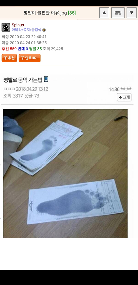 평발이 불편한 이유 | 인스티즈