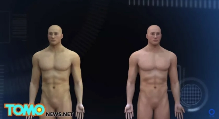 머리 이식 수술...jpg | 인스티즈