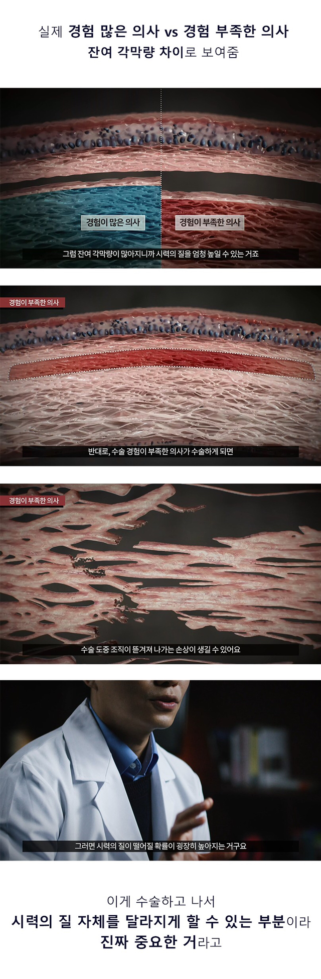 라식수술에서 중요한 것 | 인스티즈