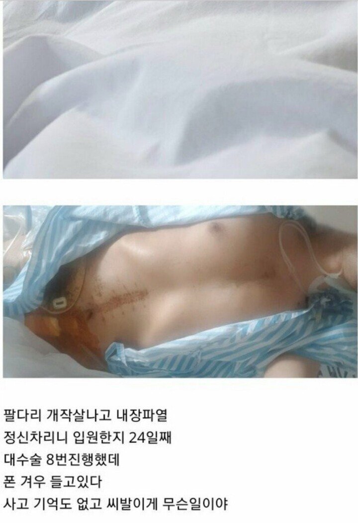 사고로 병원에서 눈 떠보니 24일 지남 | 인스티즈