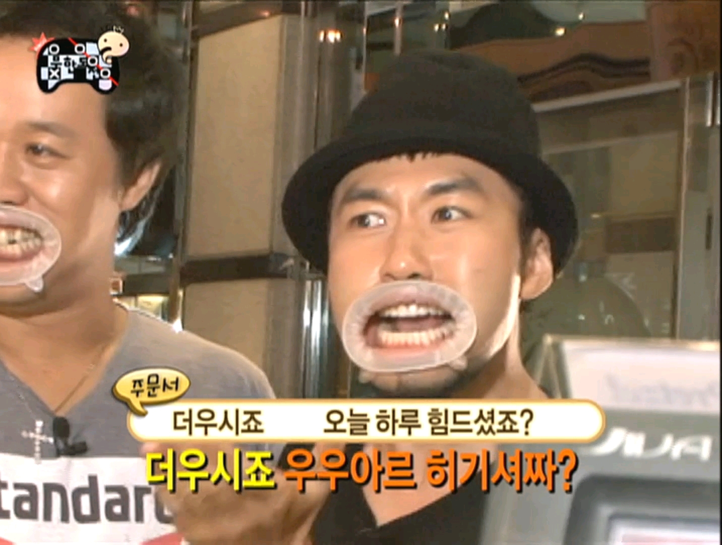 개구기로 보는 연예인 치열.jpg | 인스티즈