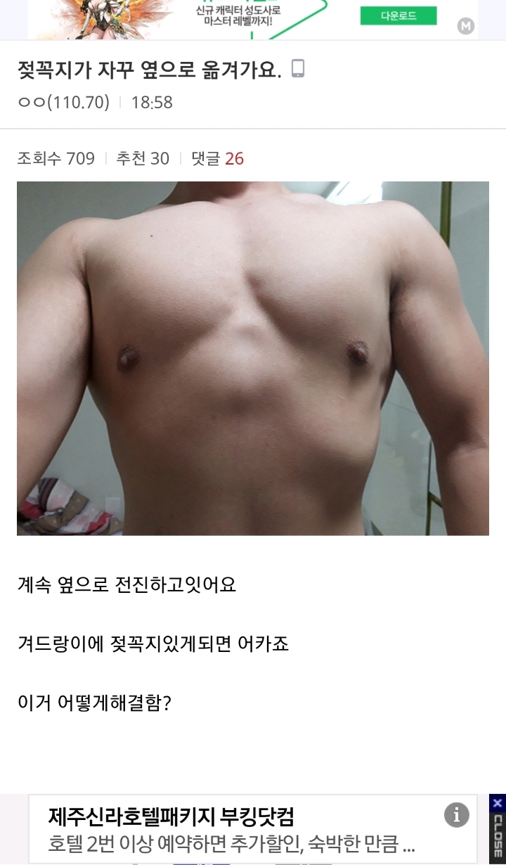 젖꼭지가 이동중이라 고민인 디씨인 | 인스티즈